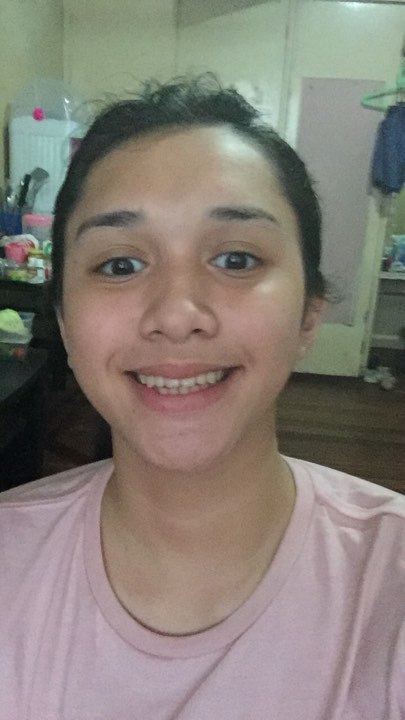 Picture 2 from Pinay teen 2024-07-13 23:17:23